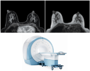breast MRI machine